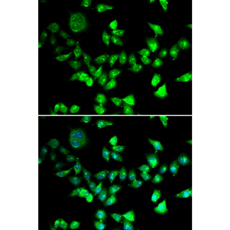 Immunofluorescence - Anti-SMC1A Antibody (A2240) - Antibodies.com
