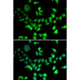 Immunofluorescence - Anti-SMC1A Antibody (A2240) - Antibodies.com