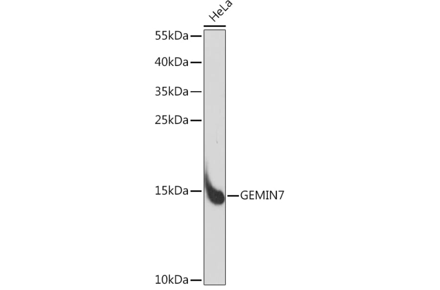 Western Blot - Anti-GEMIN7 Antibody (A91930) - Antibodies.com
