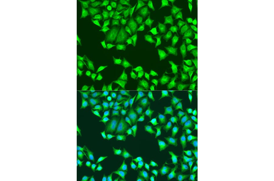 Immunofluorescence - Anti-SH2D1B Antibody (A16010) - Antibodies.com
