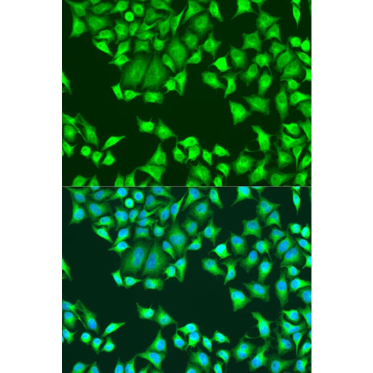 Immunofluorescence - Anti-SH2D1B Antibody (A16010) - Antibodies.com