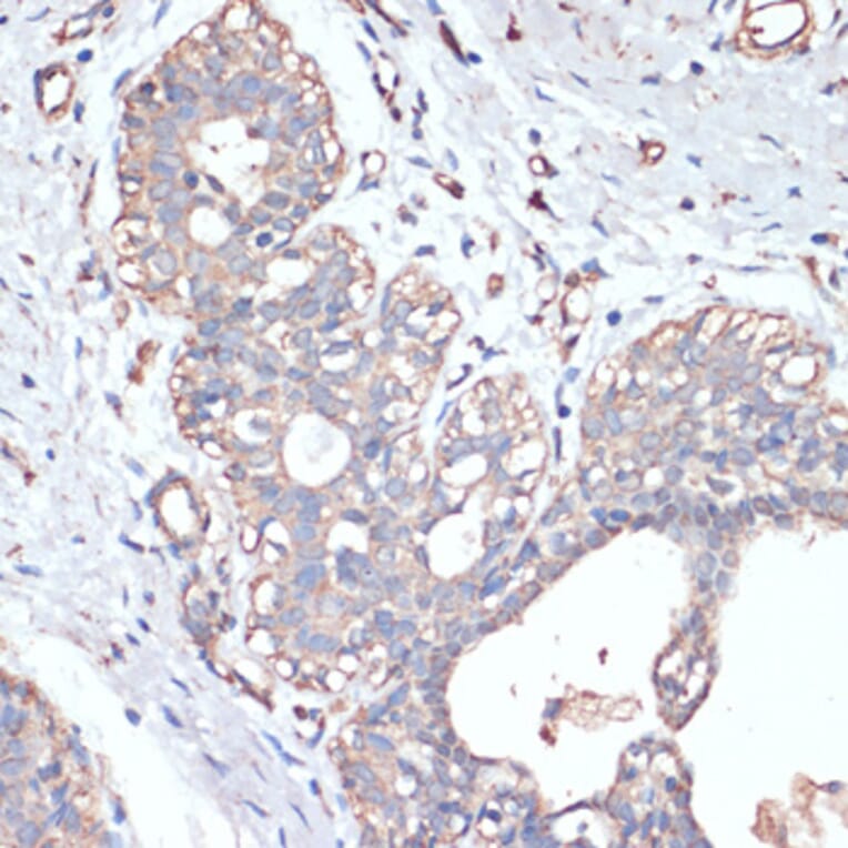 Immunohistochemistry - Anti-DGAT2 Antibody (A13890) - Antibodies.com