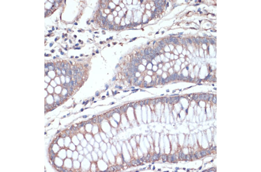 Immunohistochemistry - Anti-DGAT2 Antibody (A13890) - Antibodies.com