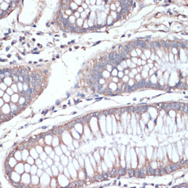 Immunohistochemistry - Anti-DGAT2 Antibody (A13890) - Antibodies.com