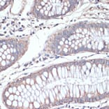Immunohistochemistry - Anti-DGAT2 Antibody (A13890) - Antibodies.com