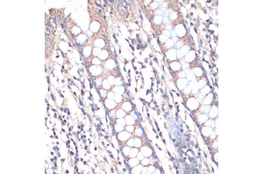 Immunohistochemistry - Anti-DGAT2 Antibody (A13890) - Antibodies.com