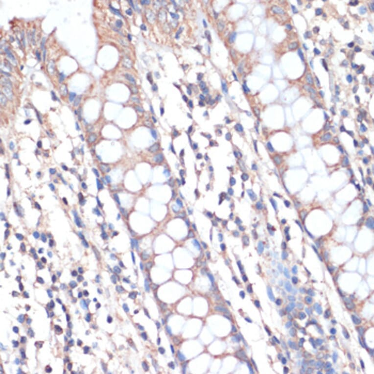 Immunohistochemistry - Anti-DGAT2 Antibody (A13890) - Antibodies.com