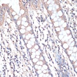 Immunohistochemistry - Anti-DGAT2 Antibody (A13890) - Antibodies.com