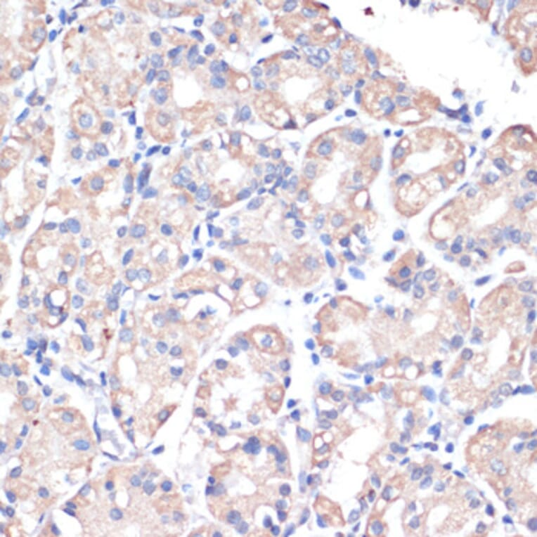 Immunohistochemistry - Anti-DGAT2 Antibody (A13890) - Antibodies.com