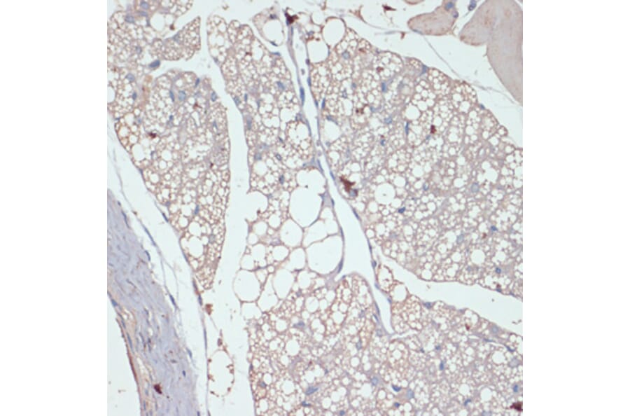 Immunohistochemistry - Anti-DGAT2 Antibody (A13890) - Antibodies.com