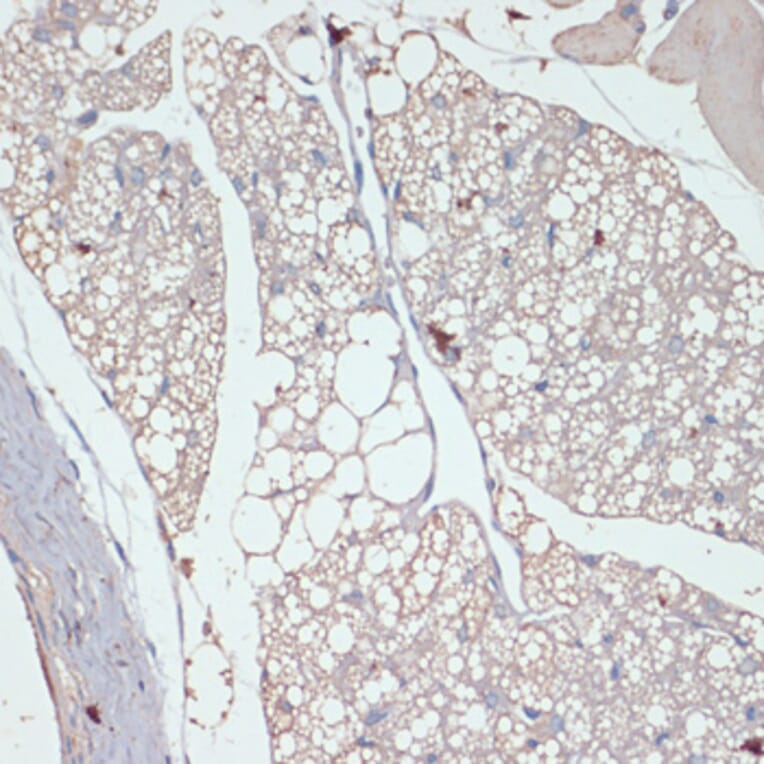 Immunohistochemistry - Anti-DGAT2 Antibody (A13890) - Antibodies.com