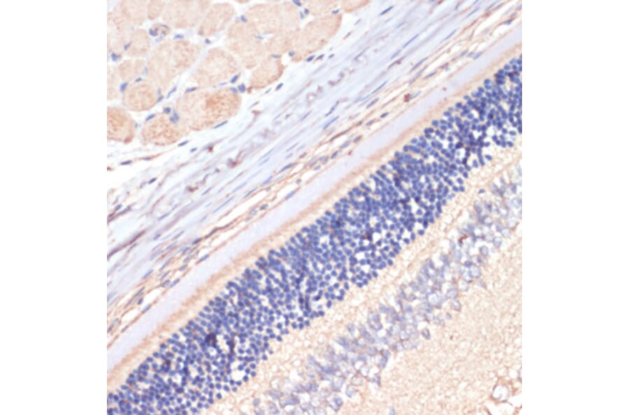 Immunohistochemistry - Anti-DGAT2 Antibody (A13890) - Antibodies.com