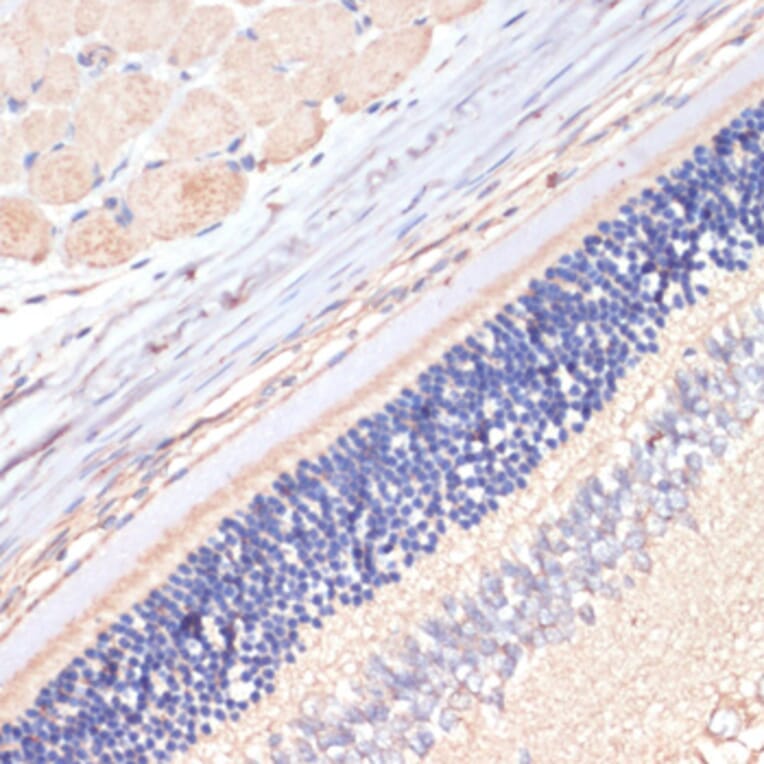 Immunohistochemistry - Anti-DGAT2 Antibody (A13890) - Antibodies.com