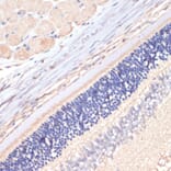 Immunohistochemistry - Anti-DGAT2 Antibody (A13890) - Antibodies.com