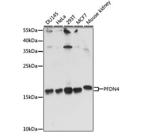 Western Blot - Anti-PFDN4 Antibody (A91935) - Antibodies.com
