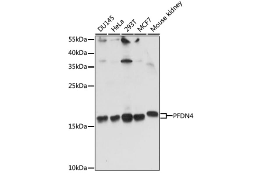 Western Blot - Anti-PFDN4 Antibody (A91935) - Antibodies.com