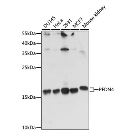 Western Blot - Anti-PFDN4 Antibody (A91935) - Antibodies.com