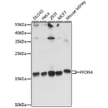 Western Blot - Anti-PFDN4 Antibody (A91935) - Antibodies.com
