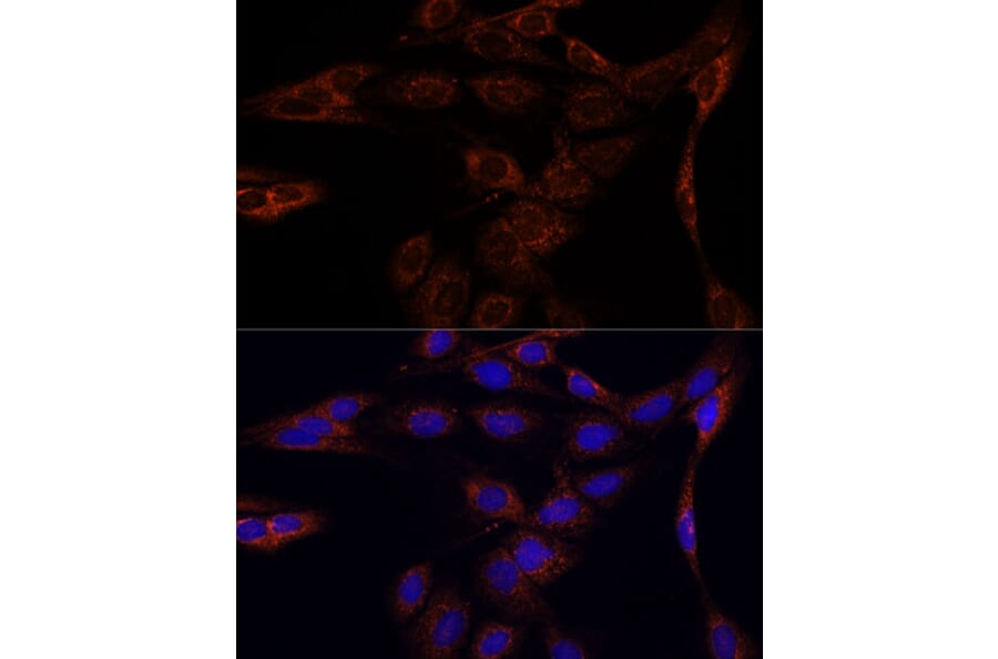 Immunofluorescence - Anti-PFDN4 Antibody (A91935) - Antibodies.com