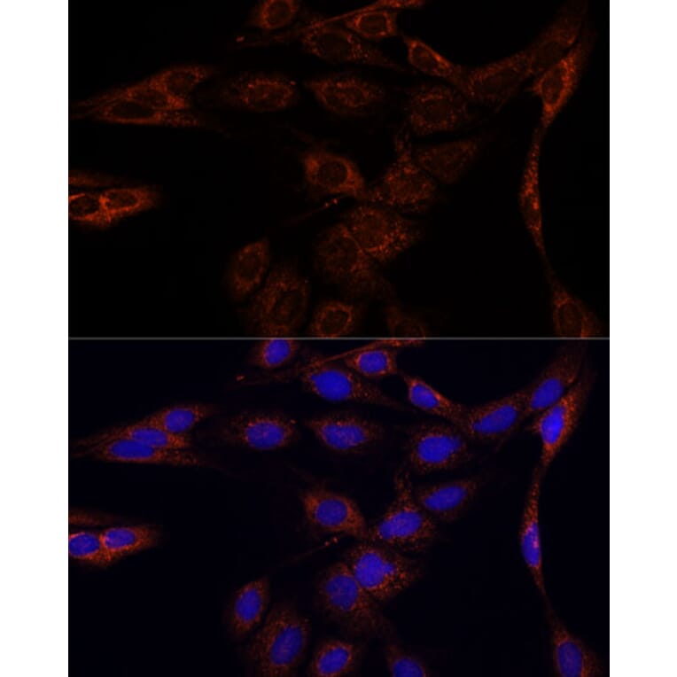Immunofluorescence - Anti-PFDN4 Antibody (A91935) - Antibodies.com