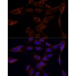 Immunofluorescence - Anti-PFDN4 Antibody (A91935) - Antibodies.com