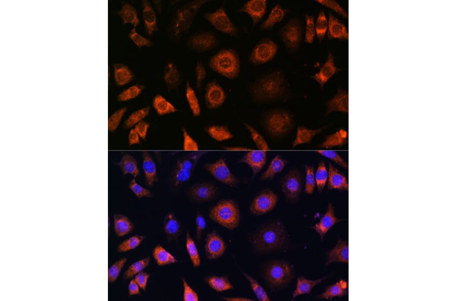 Immunofluorescence - Anti-PFDN4 Antibody (A91935) - Antibodies.com
