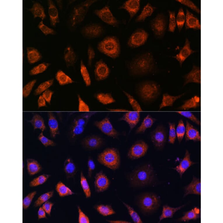 Immunofluorescence - Anti-PFDN4 Antibody (A91935) - Antibodies.com