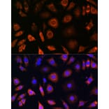 Immunofluorescence - Anti-PFDN4 Antibody (A91935) - Antibodies.com