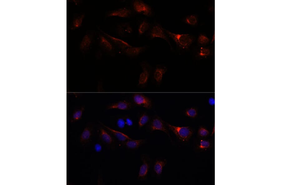 Immunofluorescence - Anti-PFDN4 Antibody (A91935) - Antibodies.com