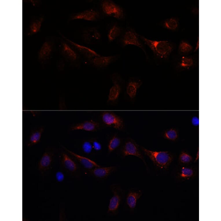Immunofluorescence - Anti-PFDN4 Antibody (A91935) - Antibodies.com