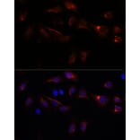 Immunofluorescence - Anti-PFDN4 Antibody (A91935) - Antibodies.com