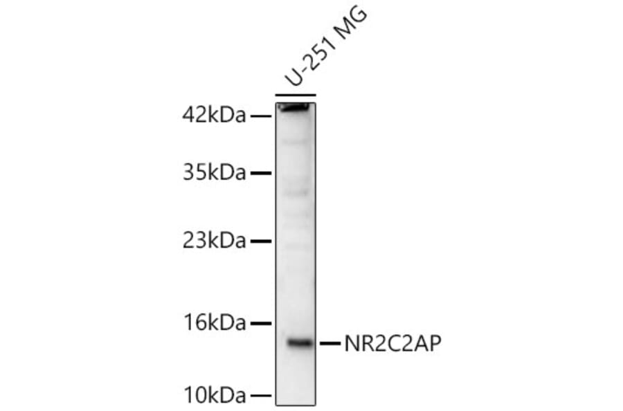 Western Blot - Anti-NR2C2AP Antibody (A91937) - Antibodies.com