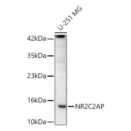 Western Blot - Anti-NR2C2AP Antibody (A91937) - Antibodies.com