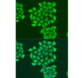 Immunofluorescence - Anti-BNIP3 Antibody (A91938) - Antibodies.com