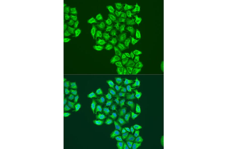 Immunofluorescence - Anti-BNIP3 Antibody (A91938) - Antibodies.com