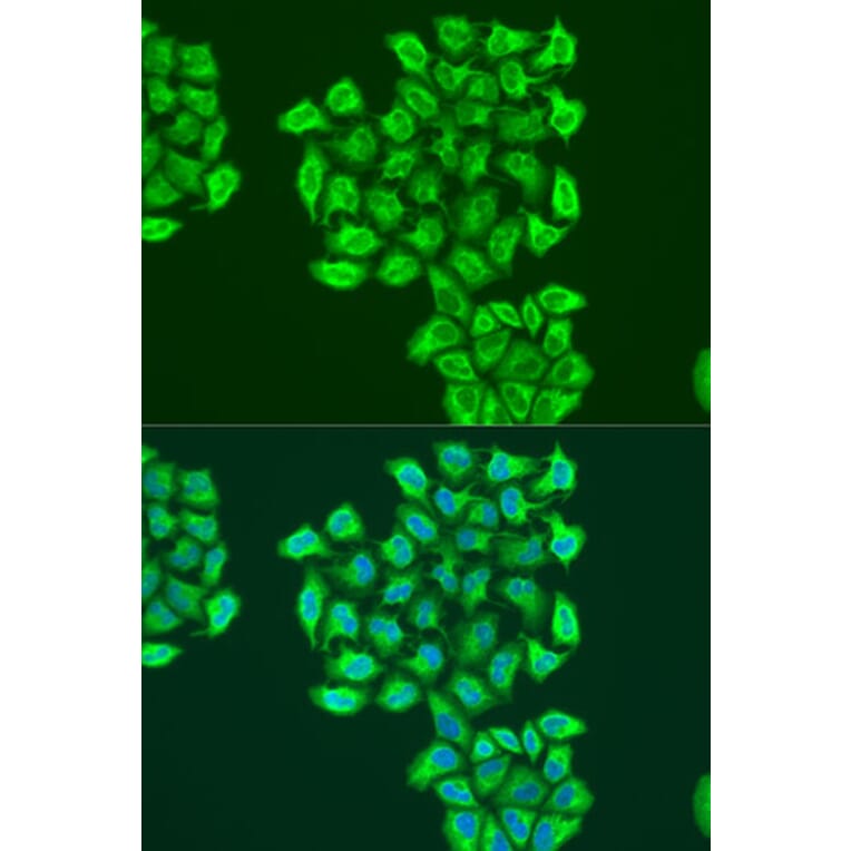 Immunofluorescence - Anti-BNIP3 Antibody (A91938) - Antibodies.com