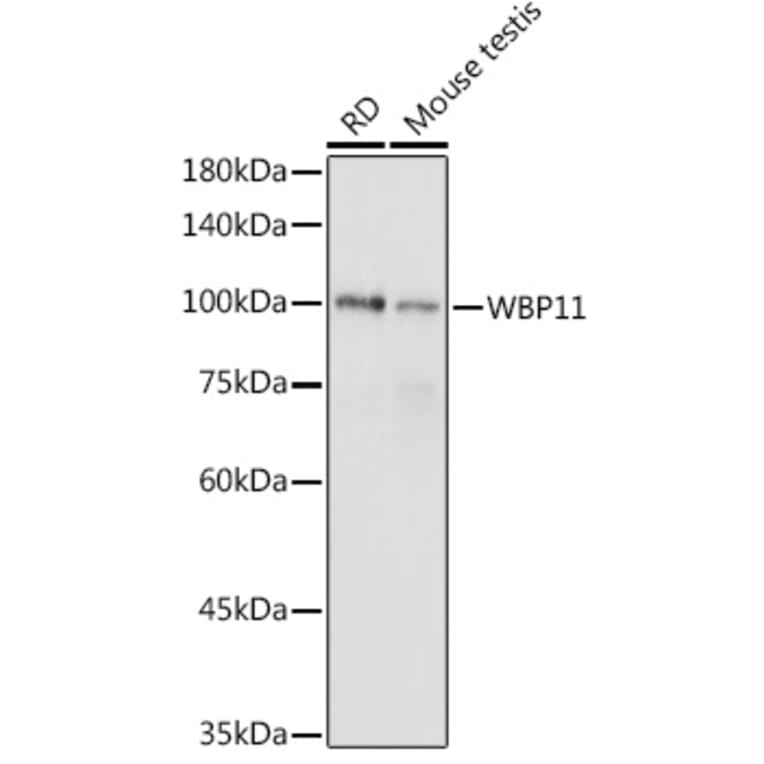 Western Blot - Anti-WBP11 Antibody (A91940) - Antibodies.com