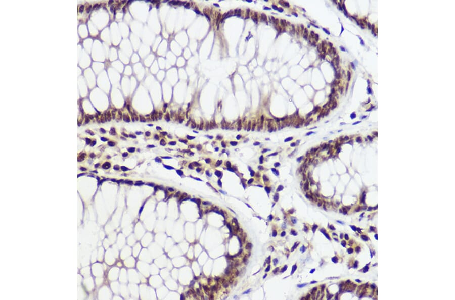 Immunohistochemistry - Anti-WBP11 Antibody (A91940) - Antibodies.com