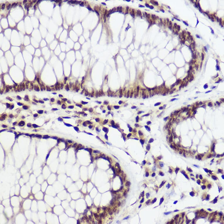 Immunohistochemistry - Anti-WBP11 Antibody (A91940) - Antibodies.com