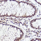 Immunohistochemistry - Anti-WBP11 Antibody (A91940) - Antibodies.com
