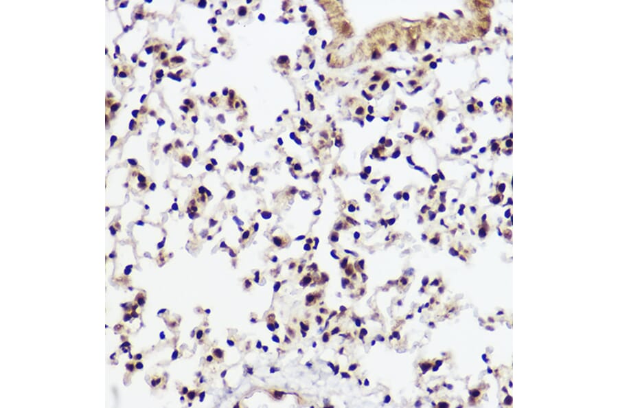 Immunohistochemistry - Anti-WBP11 Antibody (A91940) - Antibodies.com