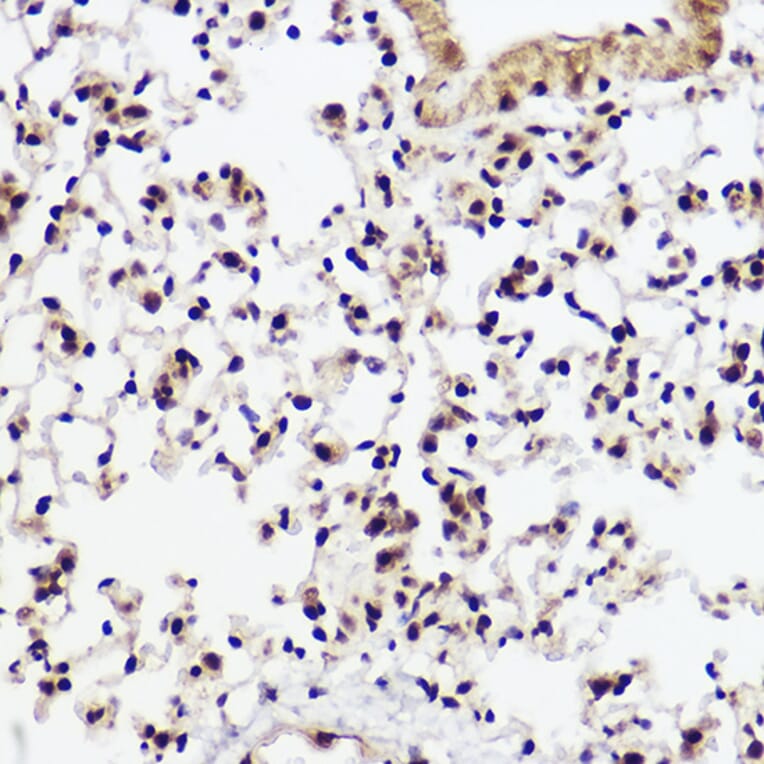 Immunohistochemistry - Anti-WBP11 Antibody (A91940) - Antibodies.com