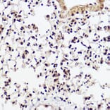 Immunohistochemistry - Anti-WBP11 Antibody (A91940) - Antibodies.com
