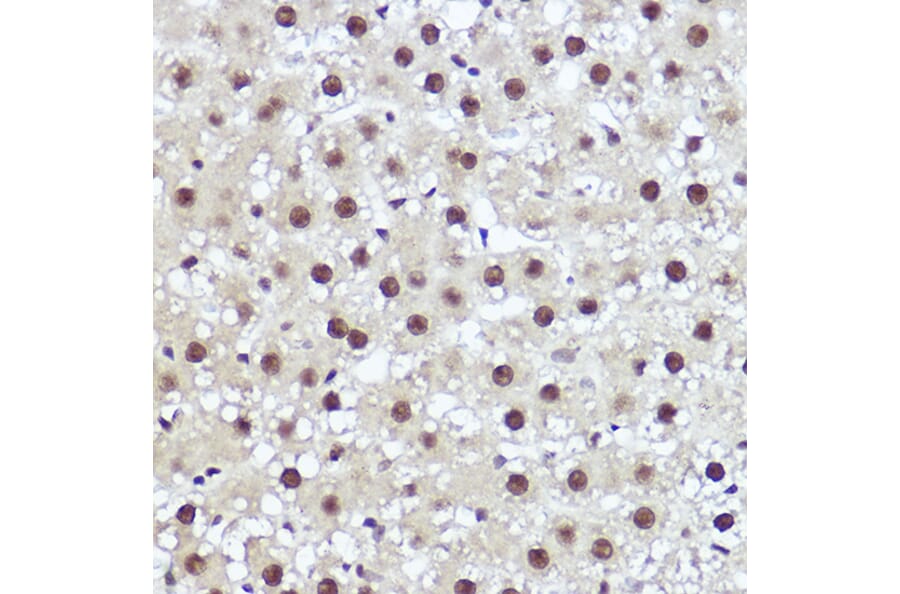Immunohistochemistry - Anti-WBP11 Antibody (A91940) - Antibodies.com