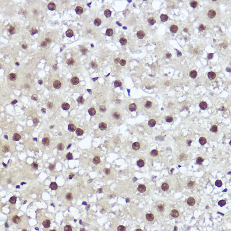 Immunohistochemistry - Anti-WBP11 Antibody (A91940) - Antibodies.com