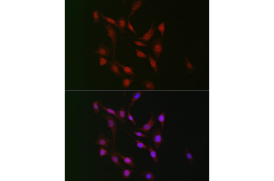 Immunofluorescence - Anti-WBP11 Antibody (A91940) - Antibodies.com
