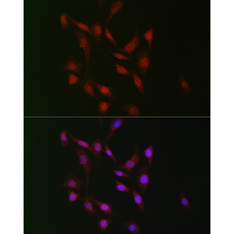 Immunofluorescence - Anti-WBP11 Antibody (A91940) - Antibodies.com