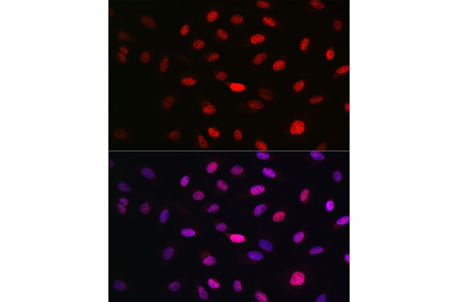 Immunofluorescence - Anti-WBP11 Antibody (A91940) - Antibodies.com