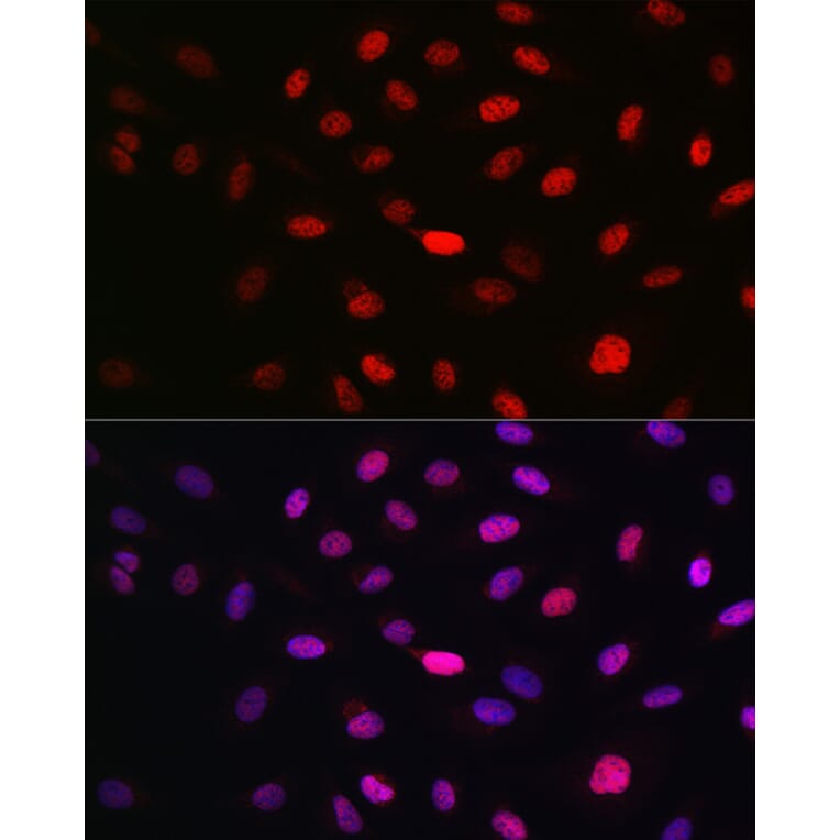 Immunofluorescence - Anti-WBP11 Antibody (A91940) - Antibodies.com