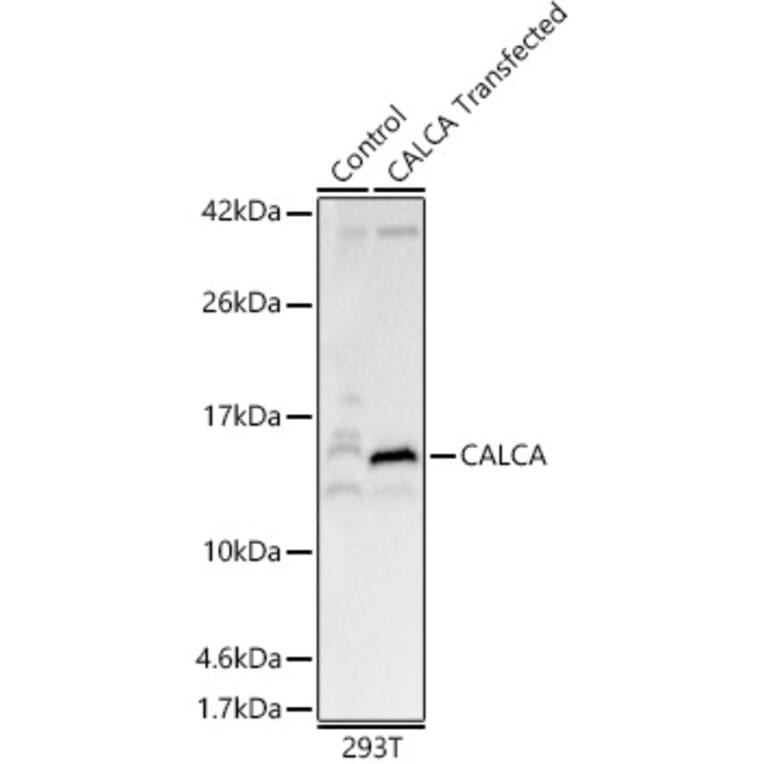 Western Blot - Anti-CGRP-1 Antibody (A91943) - Antibodies.com